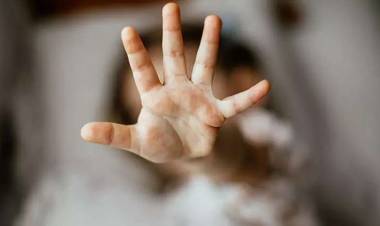 DÜnya Sağlık Örgütü'den Cinsel Tacizden Kovuldu!