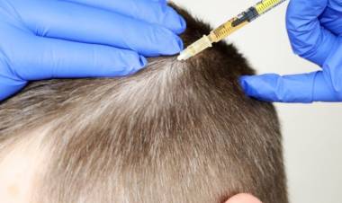 Saç Ekimi Merkezlerine Standart Getiriliyor!